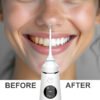 Cordless Water Flosser – original product photo 4